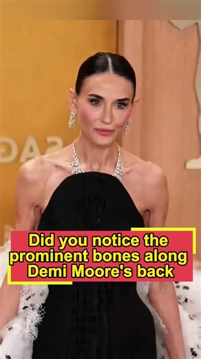 Did you notice the prominent bones along Demi Moore’s back? No one realized that 3 lingering aftereffects from filming The Substance are still impacting her.#DemiMoore#ActorAwards #AwardsSeason#fyp#foryou