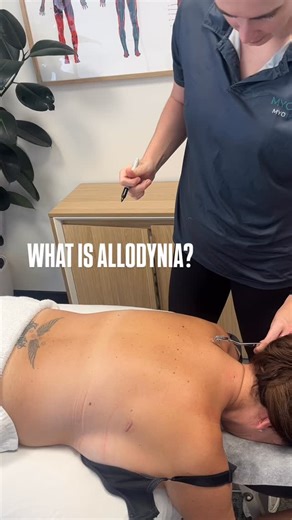 Perth Myotherapist on Instagram: "This client was in a car accident 1.5 years ago. She originally presented with right-sided neck pain, but over time, her symptoms have spread into the peripheries. In this video, we’re using a pinwheel test to assess for allodynia, a condition where normally non-painful sensations (like light touch) are experienced as pain. This can be a sign of central sensitisation, where the central nervous system essentially “remembers” the pain and keeps certain spinal leve