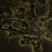 Video: One-channel Cell-attached Patch-clamp Recording