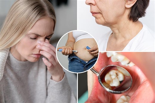 The most bizarre side effects of GLP-1 weight loss drugs, from ‘Ozempic feet’ to cavities to a runny nose