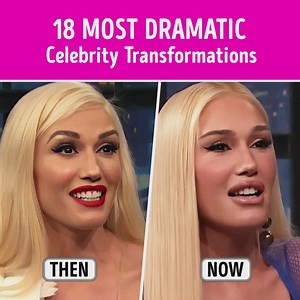 935K views · 1.9K reactions | 18 Most Dramatic Celebrity Transformations | CelebRatings | Facebook