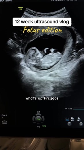 A Day in the Life of a Fetus | Ultrasound Tech Vlog