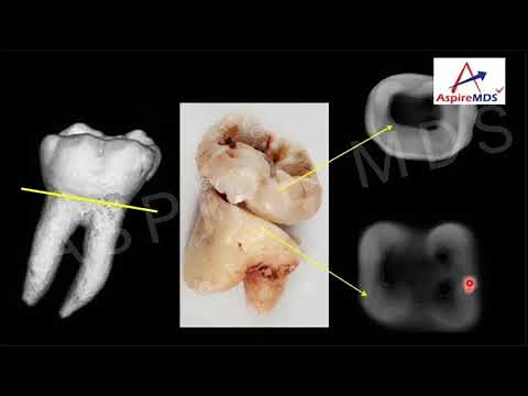 Basics of CBCT & Its use in Endodontics | Dr. Bhaumik Joshi | ASPIRE MDS