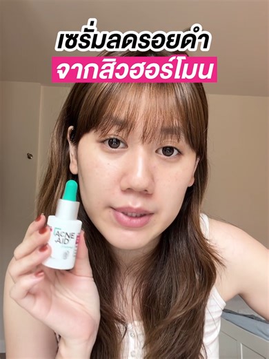 เป็นสิวยังพอทน…แต่รอยดำคือพอเลย 😩 เพราะต่อให้สิวหายแล้ว แต่รอยดำก็ยังอยู่ แถมชอบขึ้นซ้ำที่เดิมจนหน้าดูหมอง ต้องพึ่งเมคอัพหนา ๆ ปกปิดตลอด ถึงเวลาดูแลผิวให้ตรงจุดด้วย Acne-Aid Naturals Adult Acne Repair Serum ที่ช่วยลดเลือนรอยดำจากสิว ฟื้นฟูผิวให้กลับมาใส มั่นใจได้ ไม่ต้องปกปิดอีกต่อไป 🩷✨ #เปิดสวิตซ์ผิวใสลดปัญหาสิวผู้ใหญ่ตรงจุด #AcneAidNaturals #AdultAcne #AcneAidThailand #TikTokป้ายยา