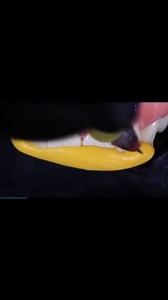 Palatal index for Palatal Shell 💡 #dentist #dentistry #dentalschool | Dental Art