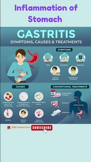 Gastritis | GI Disease | Inflammation of Stomach |Causes, Symptoms, Treatments #gastritis #acidity