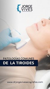 La Ecografía de Tiroides es una herramienta vital para detectar posibles alteraciones en esta glándula tan importante. A través de este examen podemos evaluar la forma, el tamaño y la textura de la tiroides, además de detectar masas, nódulos o quistes. Agenda tu Cita 📲 3243045018 Medellín: Carrera 25a #1A Sur 45 Centro Comercial el Tesoro, Torre Medica 2 Consultorio 1064 Pagina web: drjorgevivesecografias.com #Ecografiadetiroides #EnfermedadDePeyronie #SaludMasculina #CirugíaReconstructiva #dop