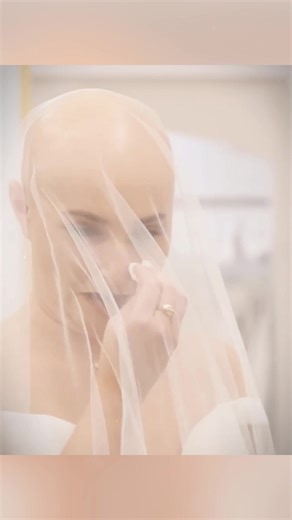 Bald Bride Rachel Shines on Her Wedding Day