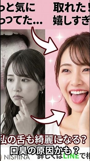 舌が白いのはなぜ？舌苔の正しいケアと口臭リスク｜仁科歯科医院 #舌が白い #舌苔 #口臭 #仁科歯科医院 #伏見区歯医者