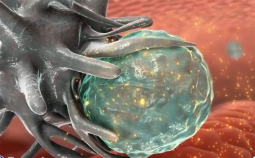 【3D演示】特应性皮炎（AD）发生原理（原版+字幕版）