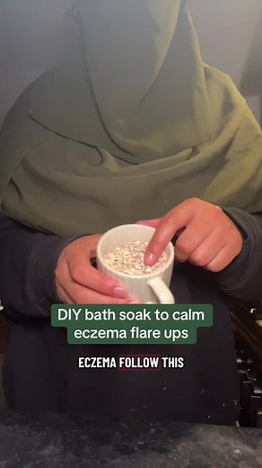 DIY Bath Soak Recipe for Eczema Relief