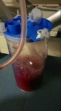 Under Water seal chest drainage system with air leak