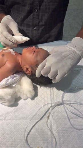 Chestryped for newborn baby😌 #sumitnicunursingstm #youtubeshorts #nursin #newbornbaby #chestworkout