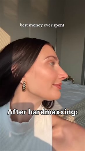 The Hidden Truth on Instagram: "Hardmaxxing is the surgical correction of structural flaws such as: rhinoplasty, bimax, BSSO, genioplasty, palate expansion. These procedures correct bone and tissue deformities that no amount of diet or lifestyle can fix. It can be highly effective and transform people’s lives, but it should only come after healthmaxxing. Fix nutrition, sleep, and environment first. Only once you’ve done everything naturally should surgery be considered. The bigger issue is why t