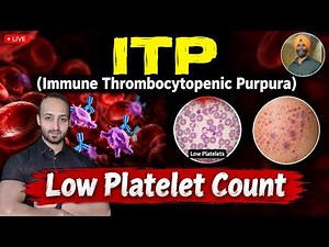 Understanding Immune Thrombocytopenic Purpura (ITP) - Signs, Symptoms, Causes & Treatment | Dr.K
