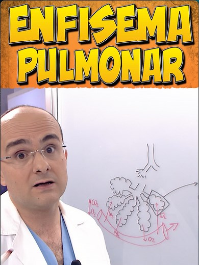 Enfisema Pulmonar y EPOC: Prevención y Tratamiento