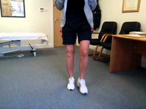 Walking 3 weeks after high tibial osteotomy
