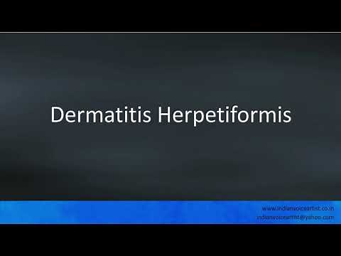 Pronunciation of the word(s) "Dermatitis Herpetiformis".