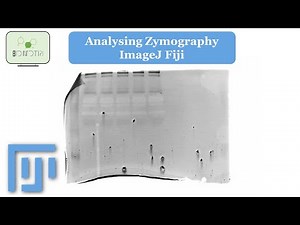 How to analyse Zymography: An Image J Tutorial