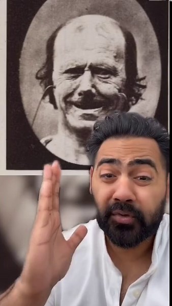 Doctor explains how to spot a Fake Smile