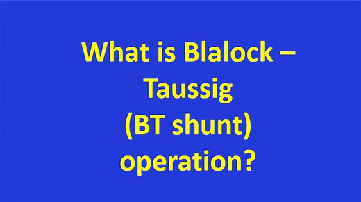 What is Blalock - Taussig  (BT shunt) operation? - All About Heart And Blood Vessels