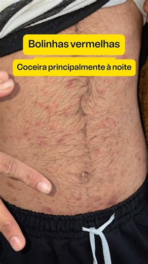 Você acha que é alergia. Pode ser muito mais que isso.