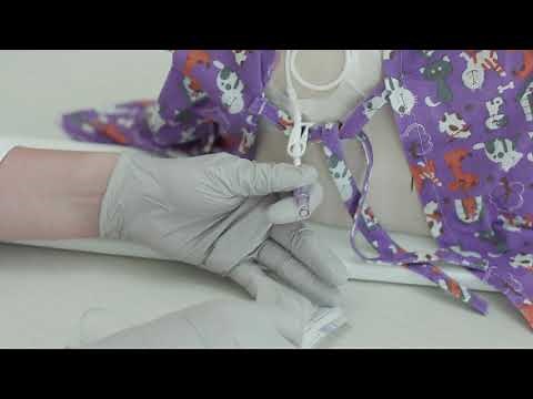 Ethanol Lock for Central Line Catheters