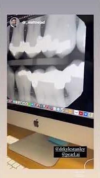 Pearl's dental AI validate Dr. Matt Nejad's x-ray evaluation