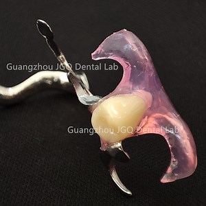 [Hot Item] Highly Resistant to Wear Rpd Partial Dentures Removable Flexible Base with Metal Frame