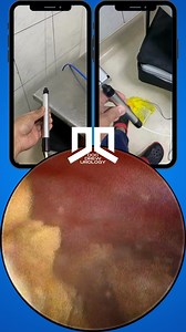 mini-PCNL ASMR ;) #docdrew #urologist #tacurongsultankudarat | Doc Drew Valdez - Urology