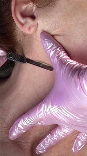 ASMR Facial Dermaplaning