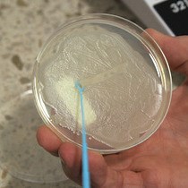 비디오: Bacillus cereus의 지방산 식별