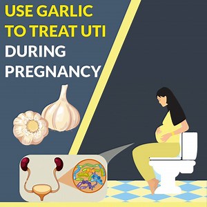 Treat urinary infections (UTI) at home using garlic | Healofy
