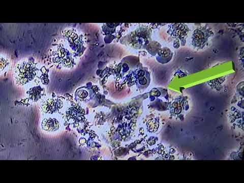 Repeated Nuclear Extrusion-like Events in Oral Biofilm? (Time-Lapse)