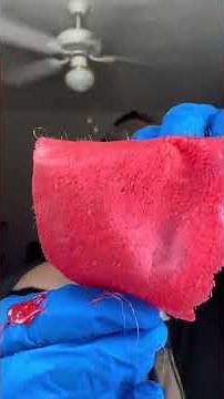 @porefect.esthetics Shares A Flawless Chin Waxing Technique!