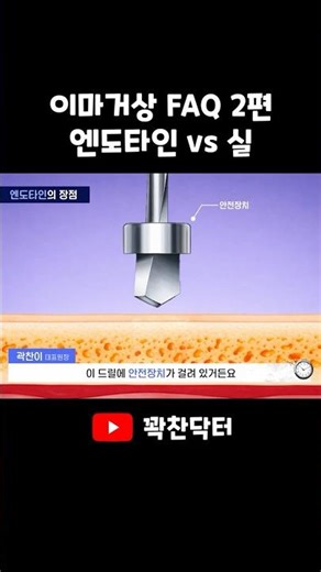 엔도타인 쓰는 이유🔥 #이마거상 #엔도타인 장점은 이거 하나로 끝