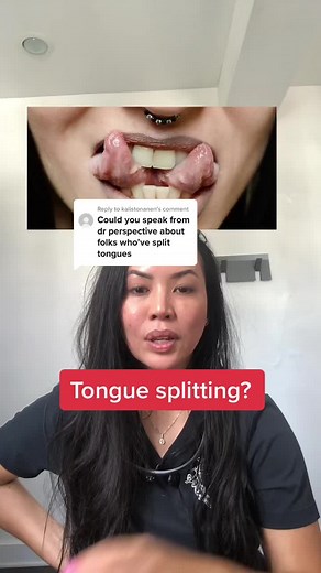 Understanding Tongue Splitting and Bifurcation Regrowth