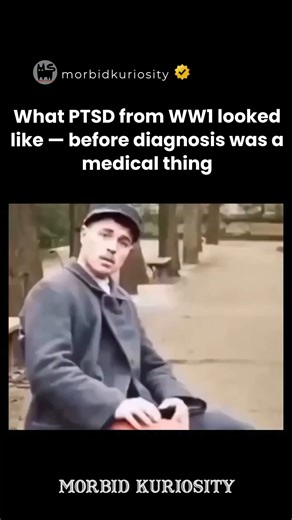 Morbid Kuriosity on Instagram: "This set of symptoms typically include a feeling of dread or helplessness that may coincide with panic, fear, flight, or an inability to reason, sleep, walk, or talk. There are terms that exist that describe similar characteristics of shell shock, like the thousand-yard stare, which both come from the stresses."