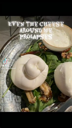 Prolapzzarella! My cheese needs a perineal proctectomy! | Anna M Toker, MD