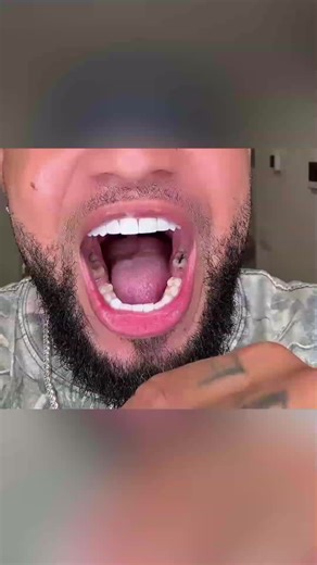 Hydroxyapatite Toothpaste for Sensitive Teeth