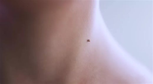 ŽENA-IN - Otestovali jsme ClinSkin Fibrocontrol: S nevzhlednými výrůstky už nemusíte na kožní. Odstraníte je snadno i doma