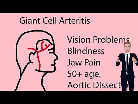Arteritis - Causes, Symptoms, Treatment, Types.