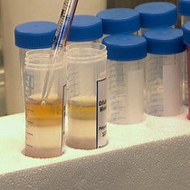 Video: Development and Identification of a Novel Subpopulation of Human Neutrophil-derived Giant Phagocytes In Vitro