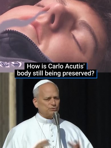 Carlo Acutis has become the first millennial saint, but the 15-year-old died of leukaemia in 2006… So how is his body still being preserved? #carloacutis #saint #pope #preserved