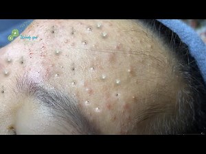 Satisfying Relaxing with Best Video 2021 Windy Spa #031