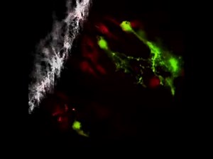 Acute Brain Trauma in Mice Followed By Longitudinal Two-photon Imaging