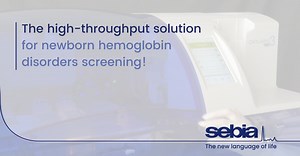 CAPILLARYS 3 DBS - Introductory video - SEBIA