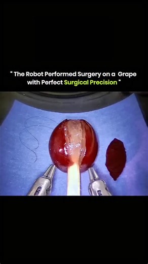 Knowledge Matrix | Watch how robotic surgery delivers incredible precision. In this demonstration, the da Vinci surgical system carefully peels a grape,... | Instagram