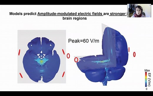 时间干涉深脑刺激原理 Mechanisms of Temporal Interference (TI) stimulation