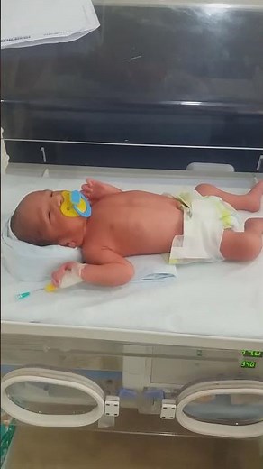 Newborn reflexes check healthy baby reflexes in nicu